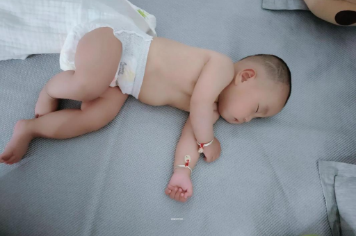 林芝宝宝上火有眼屎